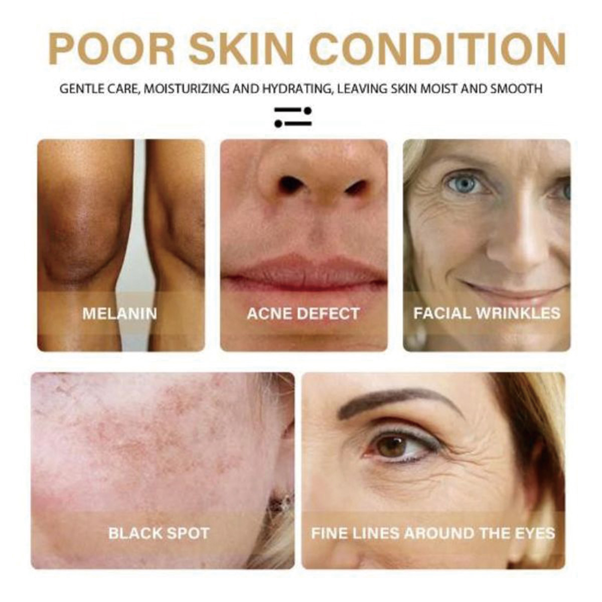 Vitamin E Facial essence Moist - đánh giá và giá Substrate Coconut Fiber